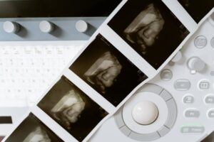 pregnancy scans ultrasound at Nucleus Scans Pathanapuram