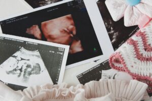 4d anomaly scan ultrasound at Nucleus Scans Pathanapuram