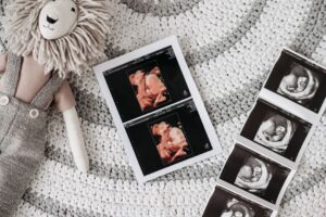 anomaly scan ultrasound at Nucleus Scans Pathanapuram