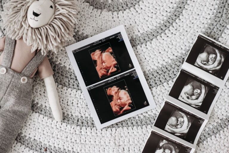 anomaly scan ultrasound at Nucleus Scans Pathanapuram