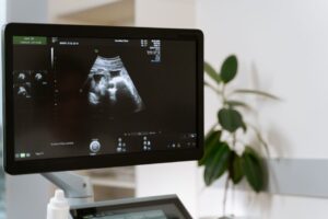 4d scan pregnancy ultrasound at Nucleus Scans Pathanapuram