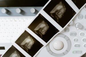 obstetric ultrasound ultrasound at Nucleus Scans Pathanapuram