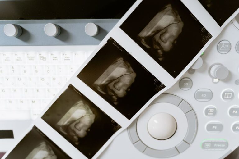 obstetric ultrasound ultrasound at Nucleus Scans Pathanapuram